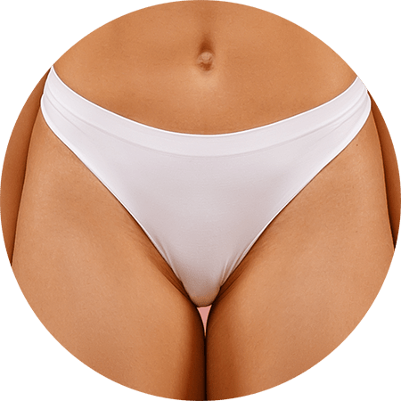 Preise Laser Haarentfernung Intimbereich Bikini Brazilian